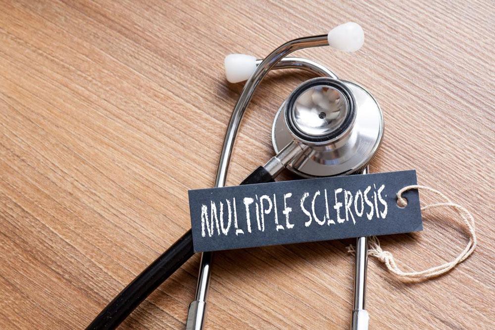 Multiple sclerosis –  Things you need to know