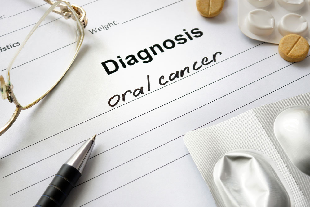 Oral Cancer – Symptoms, Causes and Management Options