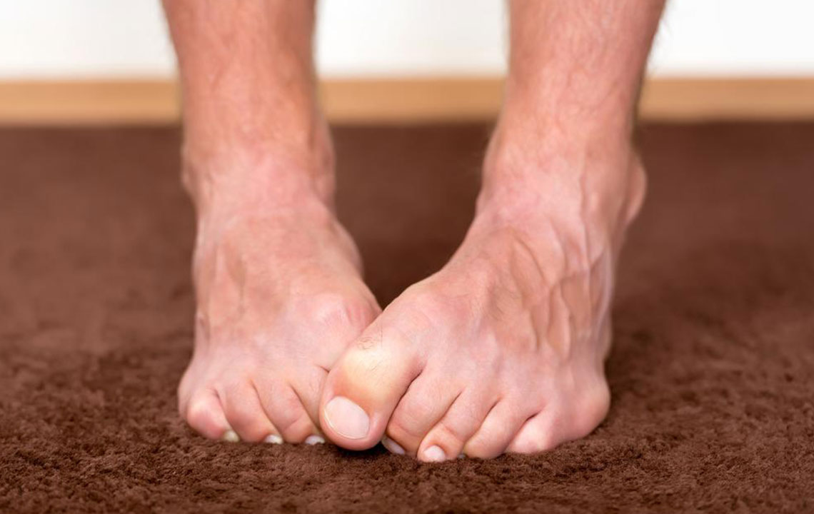 Neuropathy Foot Pain – Symptoms, Causes, Treatments and More