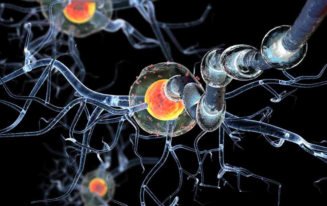 A Few Things to Know about Huntington’s Disease